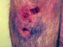 My leg, post meeting with car…